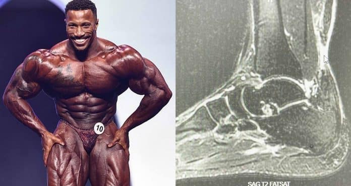 Pro Bodybuilder Patrick Moore Breaks Silence On Ruptured Achilles Tendon Injury & The Future