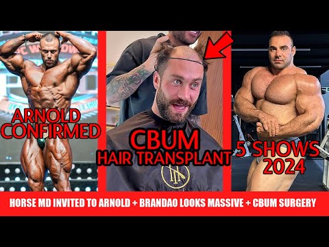 CBum and Iain Get Hair Transplants + Horse MD Invited to Arnold + Rafael Brandao MASSIVE + MORE