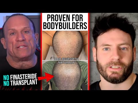 ULTIMATE HAIR GROWTH PROTOCOL | NO Hair Loss With THIS Test Ester